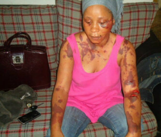 PHOTO: Gov. Fashola’s Uncle Allegedly Beat Wife, Rachel Adenuga To Coma