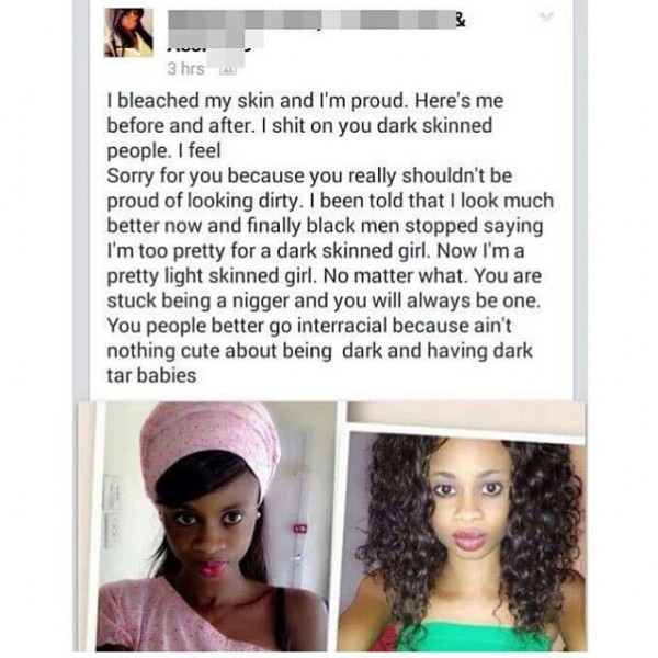 INSANITY? Bleached Girl’s Facebook Post Goes Viral
