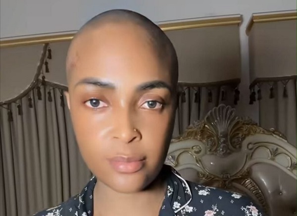 “Why I Won’t Post My Medical Results”  Blessing CEO Opens Up on Cancer Disclosure